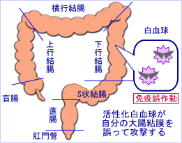 咰U